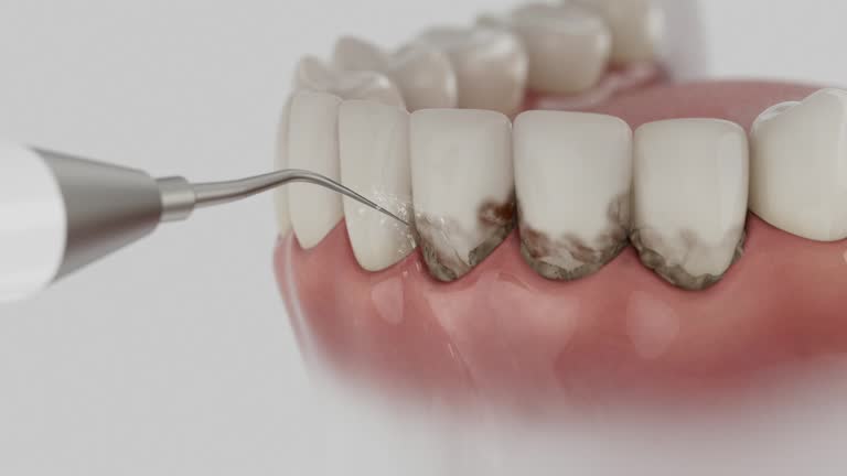 Reliable Dental contractor in Richfield, MN by Smile Center Dentistry